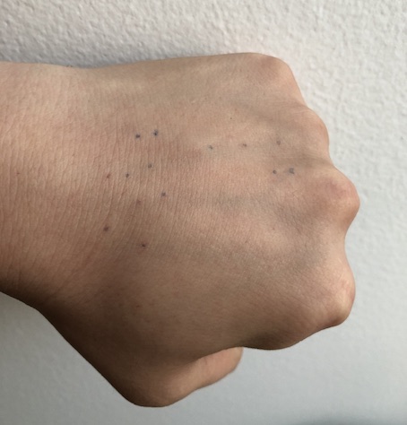 Dots of high vibration sensitivity on the back of my hand