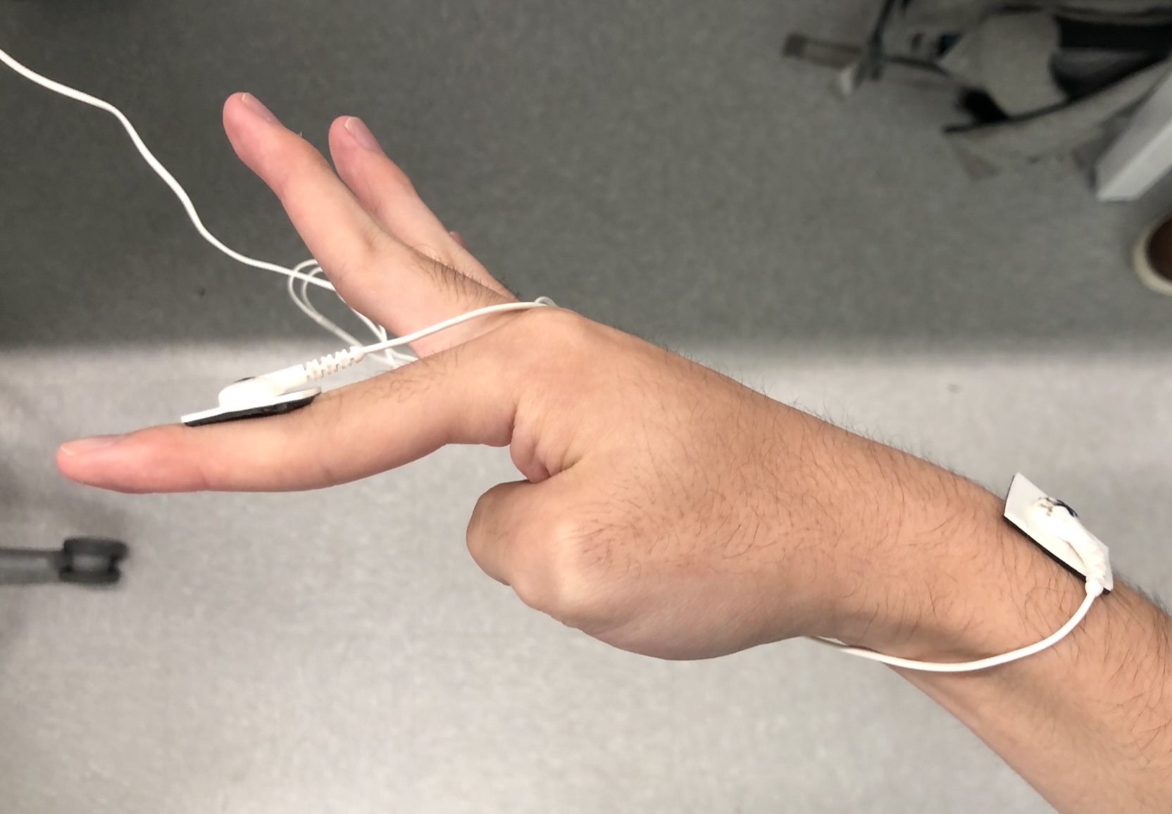 Pad placement for eliciting sensations on the front of the hand