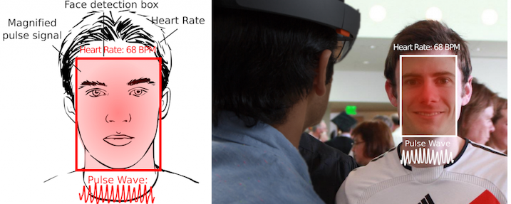 Cardiolens pulse signal